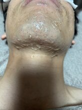 スリール(sourire)/ポップアップ