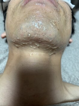 スリール(sourire)/ポップアップ