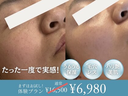 ブルーム(BLOOM)の写真