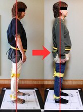 チャラク(charaku)/【60代S様：首、肩こり・猫背】