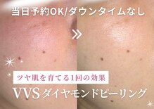 ウノ アッベリーナ(UNO × abbel'lina)