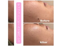 ビューティスト(Beautist)の雰囲気（【韓国肌管理】ティファニーピールで毛穴レス/痩身/毛穴/小顔）