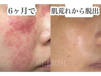 ベルリール 浜松店(BELRIR)の写真