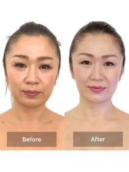 サロン ド リアン(salon de lien)/Before /After(2)