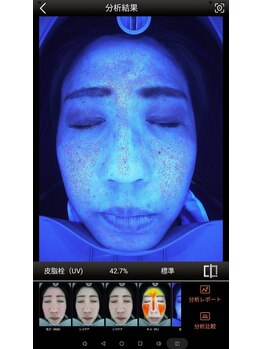 メンズミーシェ(Men's Meshie)/AI肌診断機