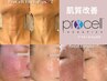 【何をしても改善されない肌】プロセルセラピーズ　相談0円/初回体験40,000円