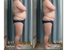 アクア(AQUA)/AQUAデトックス