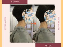 整体院 來花 福岡薬院店(KOHANA)/Bifo/Afuta 2（首コリ・肩こり）