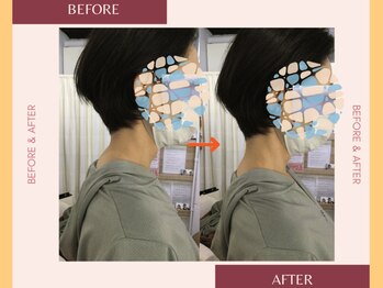 整体院 來花 福岡薬院店(KOHANA)/Bifo/Afuta 2（首コリ・肩こり）