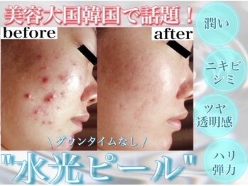 ホワイトアクア 四日市店(WHITE AQUA)/四日市ララピール/水光肌