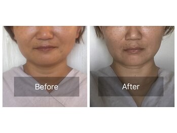 ハッピービューティーサロン じゆう(Happy Beauty Salon J∞YOU)/４０代 ！Mさん♪