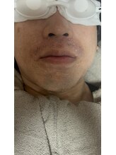 スリール(sourire)/ポップアップ