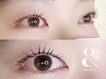 アイアンドネイル ブライト(bright)/アンドヘルシー