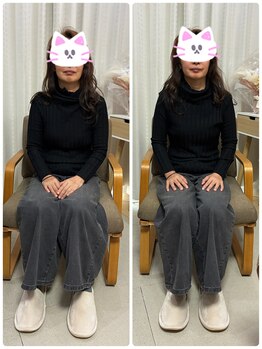 ランス/よもぎ蒸し×筋膜リリース1回