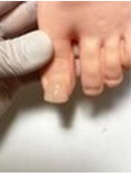 爪の悩みを解消できる（ケア含む）