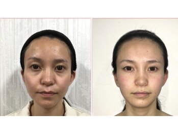 小顔整体研究所 KSラボ 藤が丘店/