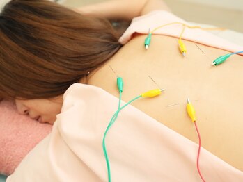 ハリ リリー カニエ/電気鍼