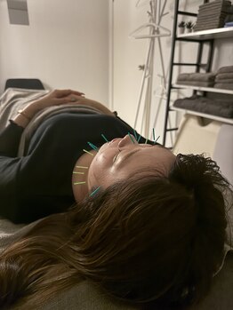 ラフテル鍼灸整骨院/阿波座駅徒歩圏内で美容鍼◎