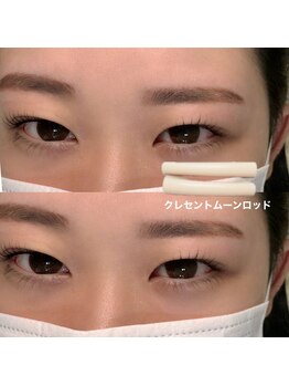 ジョリー(Jolie)/