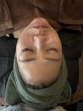 エワル 半田店(ewalu)/REVIハーブピーリング【5】