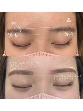 ヒース(Heath)/before&after