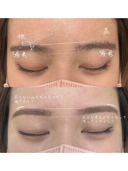 ヒース(Heath)/before&after