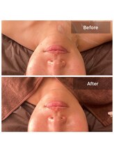 プライベートサロン アール(R)/カーボキシー×選べる生パック