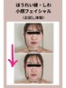 【ほうれい線/しわ】老け見えにストップ！たるみ改善小顔フェイシャルお試し