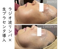 シストワ(sistoi)