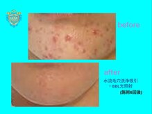 リュクス(LUXE)/ビフォーアフター