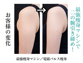 ビービーサロン 池袋(B.B salon)/電磁パルスで二の腕引き締め◎