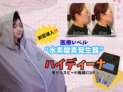 ヨサパーク リア 紫原店(YOSAPARK Li'a)の写真