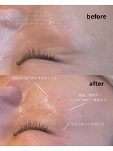 オニュ(onyu)/敏感肌さんもご相談下さい！