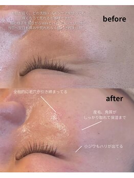 オニュ(onyu)/敏感肌さんもご相談下さい！