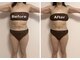 エステティックサロン リリアンの写真/『最近痩せにくくなった…』それ、冷えと代謝のせいかも？リリアンで叶える根本体質改善