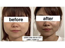 グリーン鍼灸整体院(green鍼灸整体院)の雰囲気（１回でも体感してもらえますが、継続する事でより効果がでます！）
