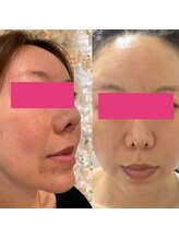 こんな方におすすめ♪