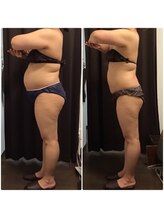 美やせ専門店 ビープロデュース 西尾店(B'PRODUCE)/【40代の方のビフォーアフター】