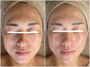 メイン(main)/★before after★