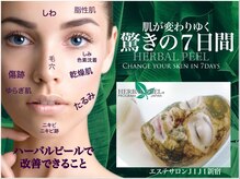 エステサロン ジジ 新宿(JIJI)/ハーブピーリング、プラズマ新宿