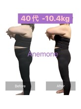 アネモネ/ダイエット/痩身/耳つぼ/腸活