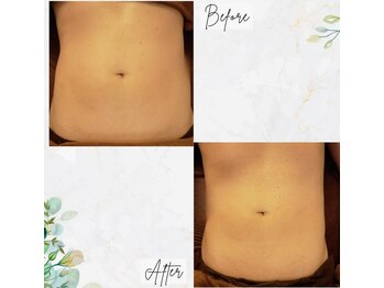 グリーン 町田(Green)/【痩身】ハイパーナイフ×キャビ