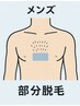 メンズ【部分脱毛一部位】気になる部分にだけお得に！