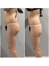 fallon beauty　痩身/フェイシャル/フェム・オムケア/アロマ/ボディケア/痩身インドエステ