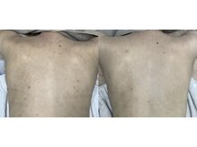 スリリアン 銀座/★お客さまビフォーアフター★