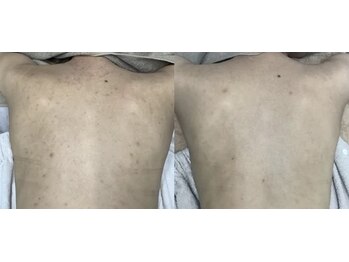 スリリアン 銀座/★お客さまビフォーアフター★