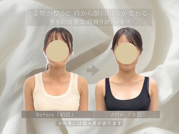 ステップ木更津鍼灸治療院/姿勢改善で印象チェンジ