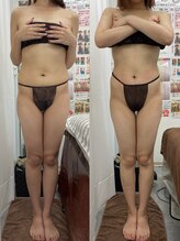 エスプレッソ(espresso,)/【全身痩身】美しいウエストに♪