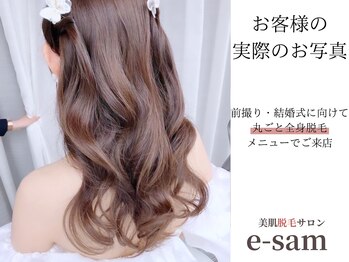 イーサム(e-sam)/丸ごと全身脱毛