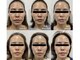 グロウラ(GrowRa)の写真/<年齢肌の救世主>気になる口元のサインを徹底ケア！引き上がったような若々しい印象へ